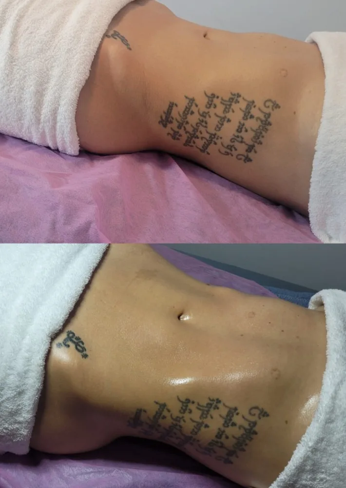 drenaje linfatico abdomen anabella estetica brazil