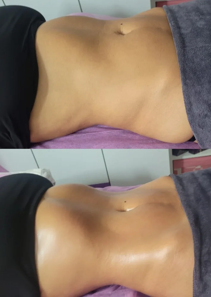 drenaje linfatico anabella estetica brazil